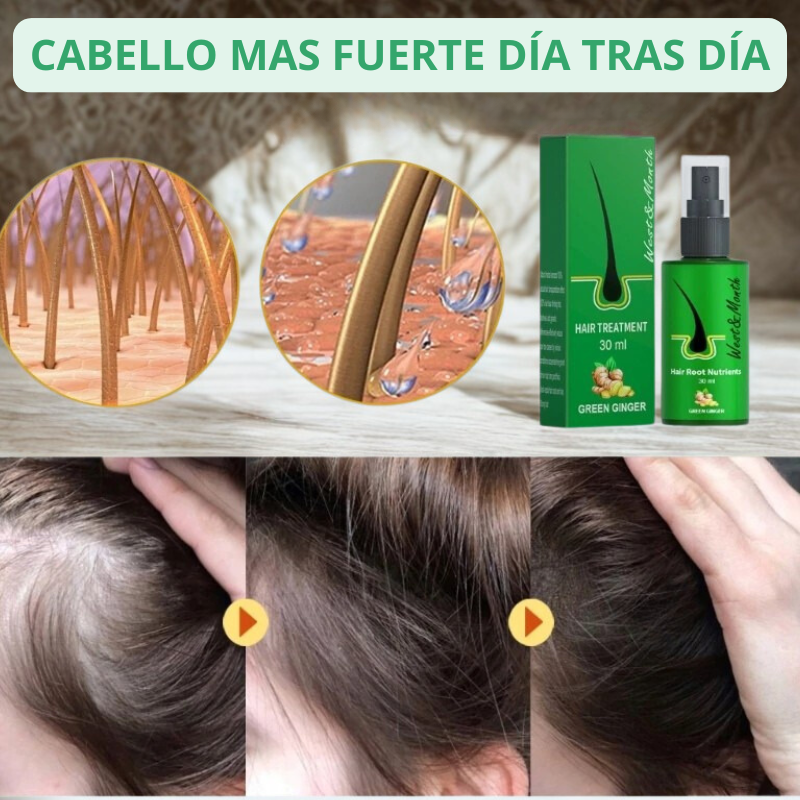 ¡1+1 GRATIS SOLO HOY! Spray del crecimiento del cabello- Velania™