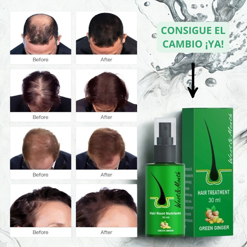 ¡1+1 GRATIS SOLO HOY! Spray del crecimiento del cabello- Velania™